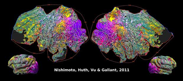 Parcellation of the brain : fRMI