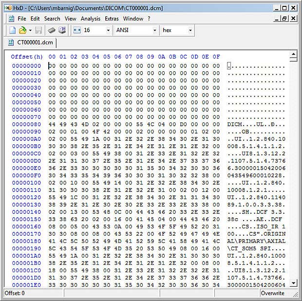 DICOM File displayed in Hexeditor