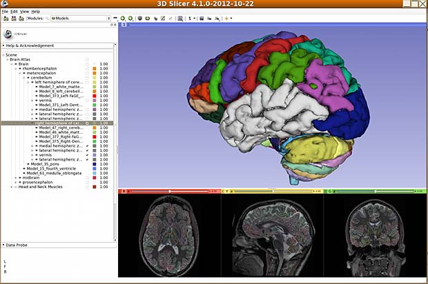 Centricity Dicom Viewer 3.1 Free Downloadbfdcml