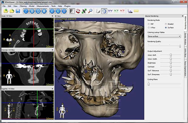 Centricity Dicom Viewer 3.1 Free Downloadbfdcml