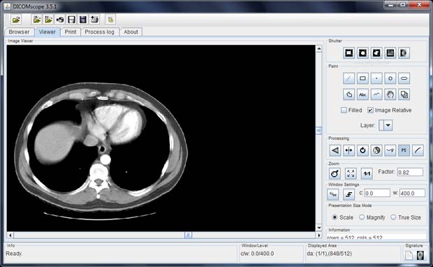 DICOMscope 