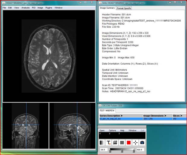 Mango DICOM viewer