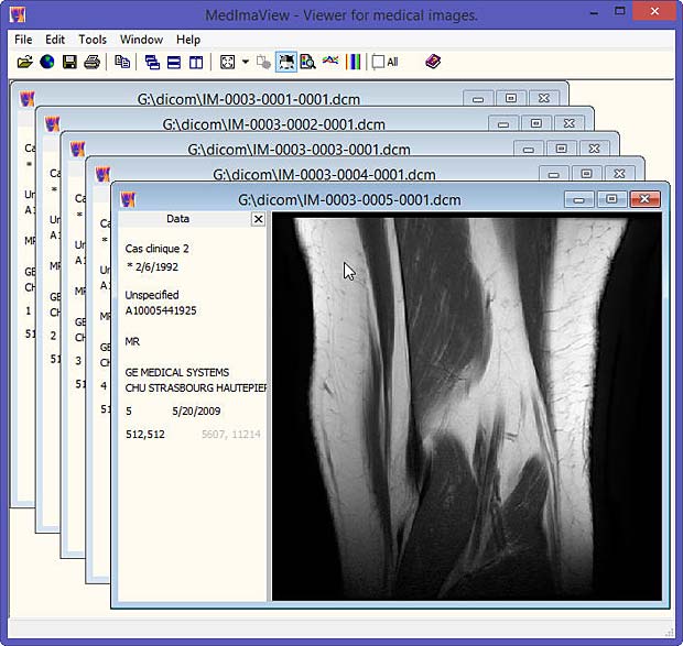 MedimaView DICOM viewer