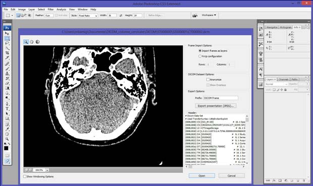 Photoshop CS3 with DICOM support