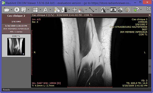 RadiAnt DICOM viewer