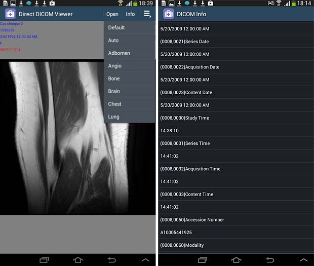 Direct Dicom viewer image and metadata panels