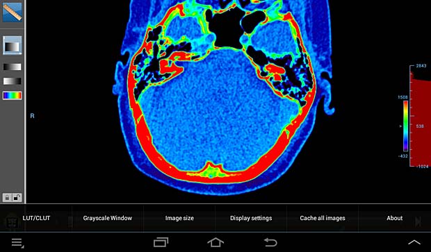 Droid DICOM viewer image panel with 