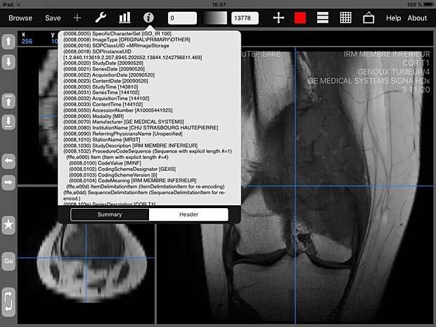 iMango image viewer with metadata info panel