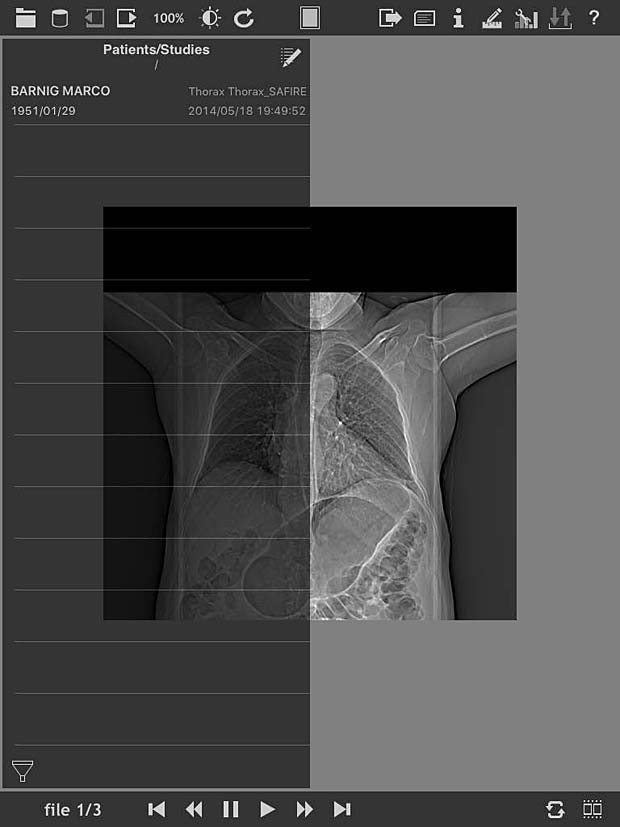 loDICOM Viewer image panel