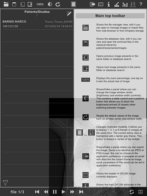 loDICOM Viewer user guide