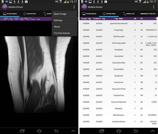 Mobile Dicom Viewer image and metadata panels