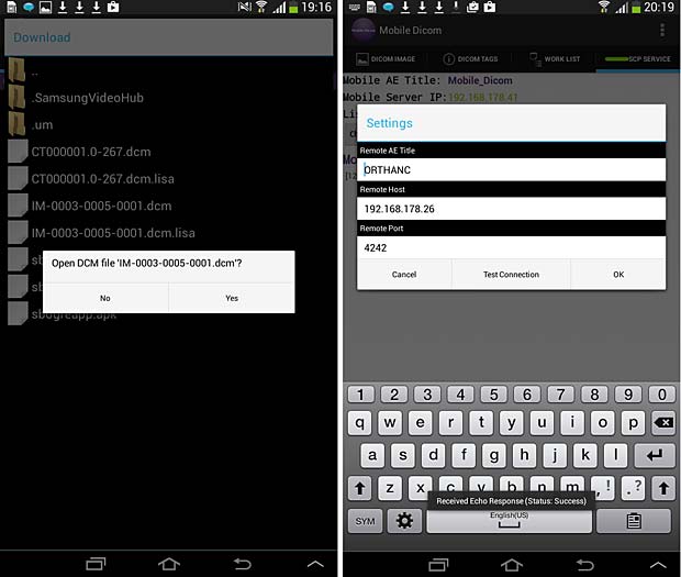 Mobile Dicom Viewer load and config panels