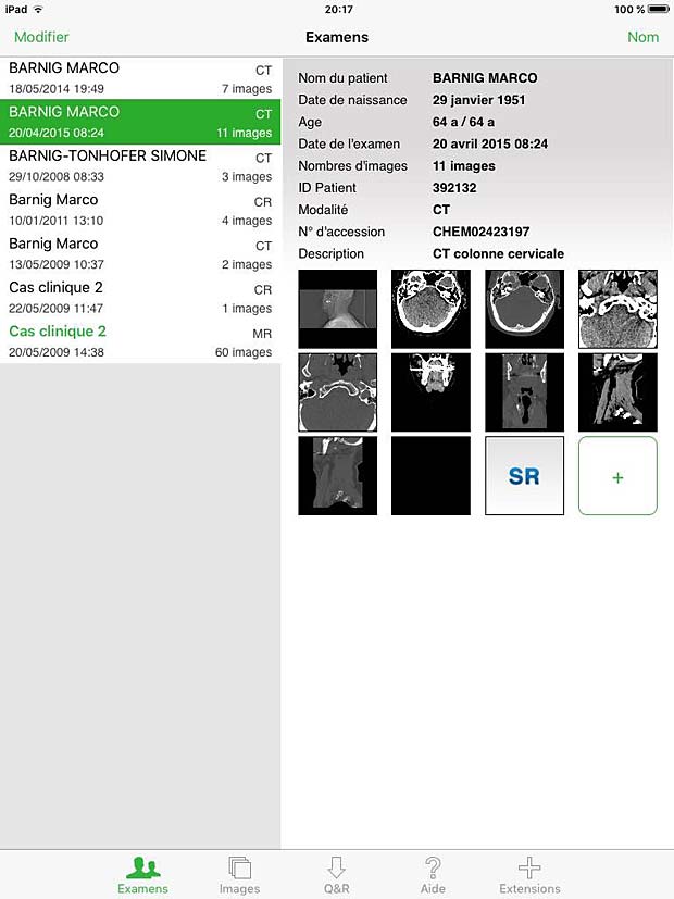 Osirix HD Exams Panel