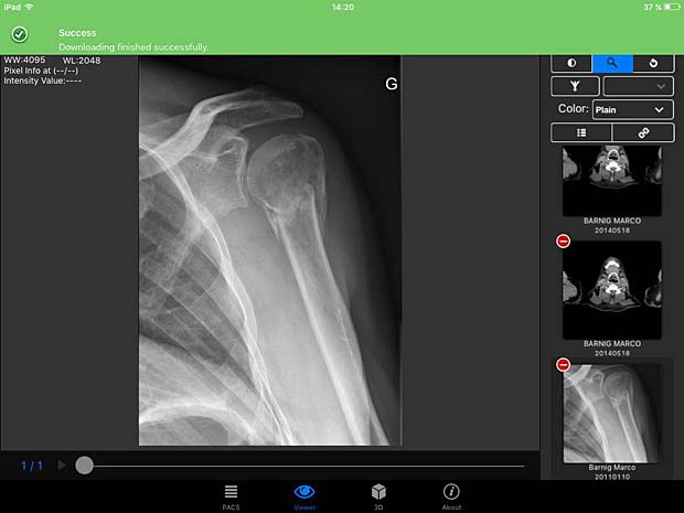 PACSDICOM Viewer download success