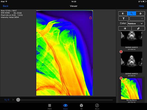 PACSDICOM Viewer images with rainbow LUT