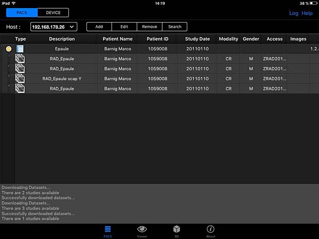 PACSDICOM Viewer worklist