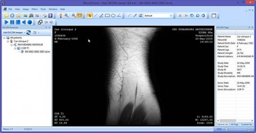microdicom | Internet with a Brain