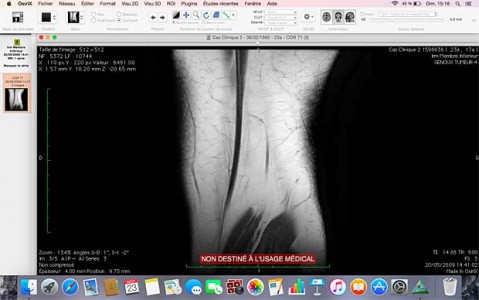 osirix lite tutorials osirix lite tutorials